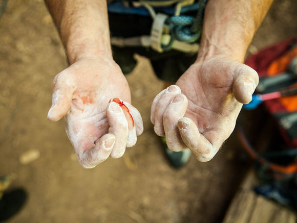 Grip Goals, Strong Climbs: Tackling blisters and callouses in your climbing, ninja warrior, or fitness journey